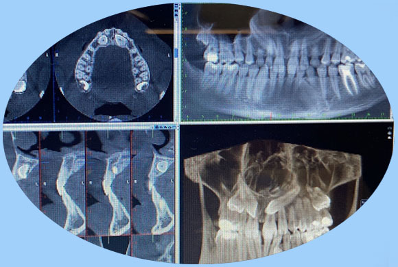 Tac 3D Odontològic